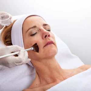 TCA – miejscowa terapia blizn