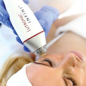 Thermolifting mikroigłowy infini