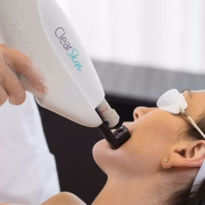 Clearskin – laserowa terapia trądziku i blizn potrądzikowych